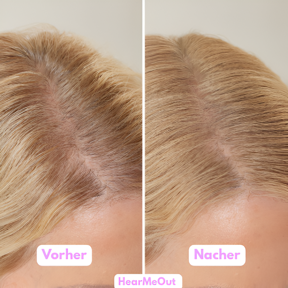 HairFiller für Frauen